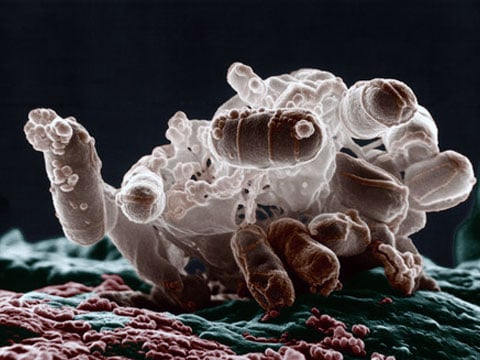 Escherichia coli je fakultativně anaerobní gramnegativní bičíkatá tyčinkovitá bakterie žijící v tlustém střevě teplokrevných živočichů. Je jedním s nejdůležitějších zástupců střevní mikroflóry a její přítomnost je nezbytná pro správný průběh trávicích procesů ve střevě.